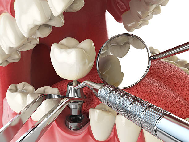 Best After-Hours Emergency Dentist in Gman, IL