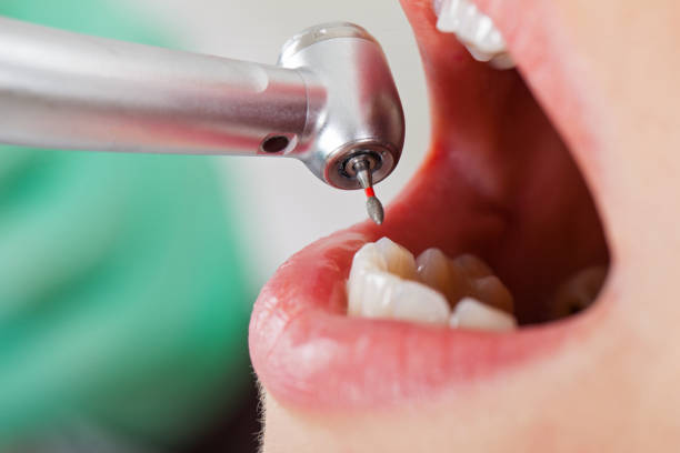 Best Walk-In Emergency Dentist in Gman, IL